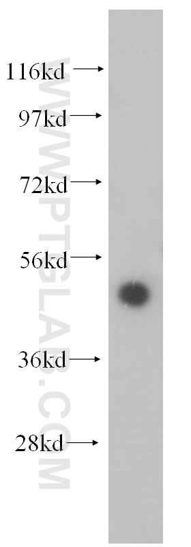 WB analysis of mouse thymus using 14557-1-AP