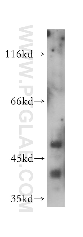 Western Blot (WB) analysis of HeLa cells using RBAP48 Polyclonal antibody (14557-1-AP)