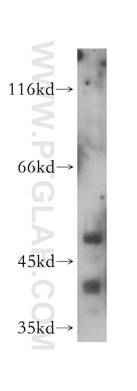 WB analysis of HeLa using 14557-1-AP