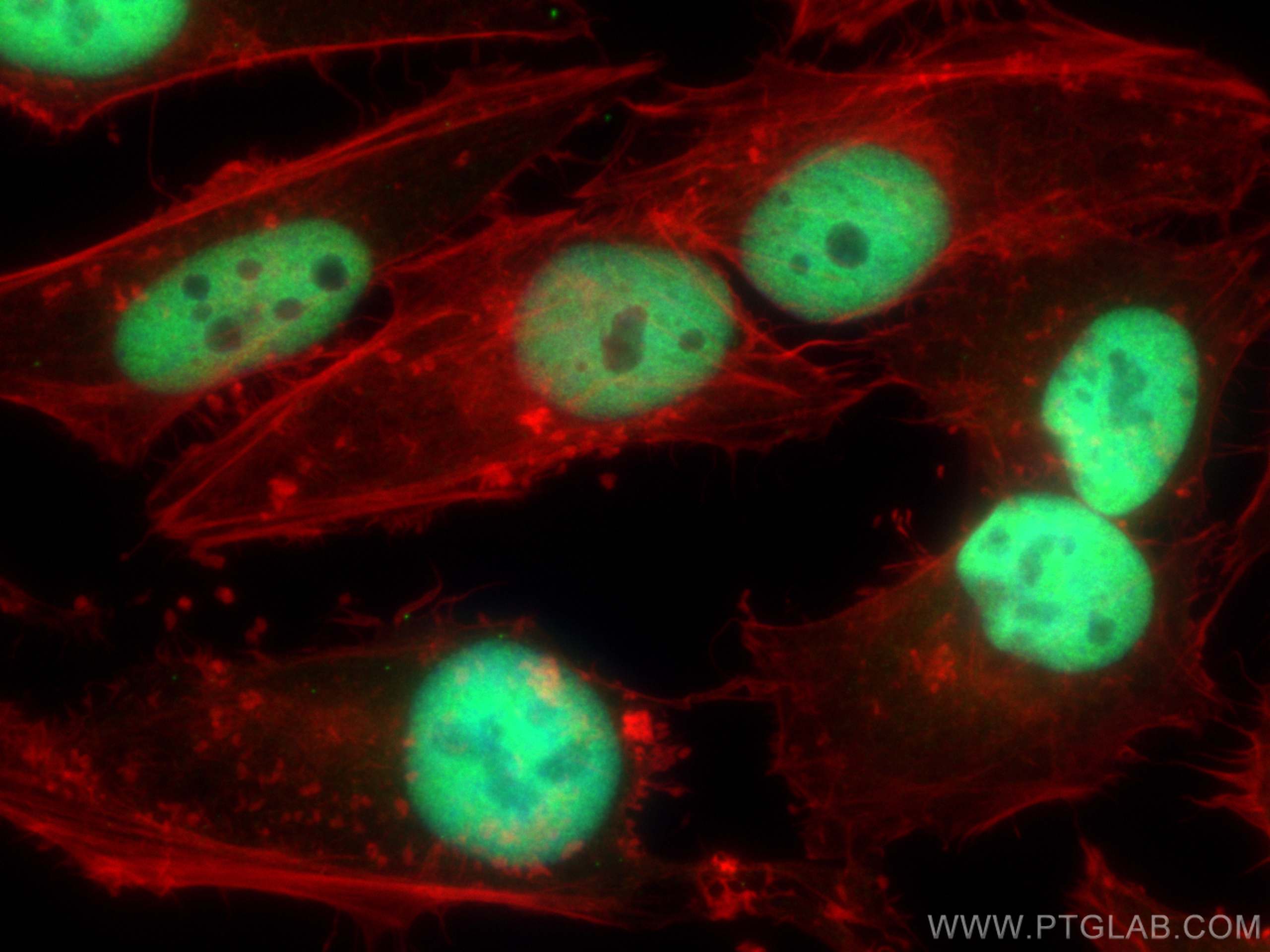 IF Staining of HeLa using 20364-1-AP