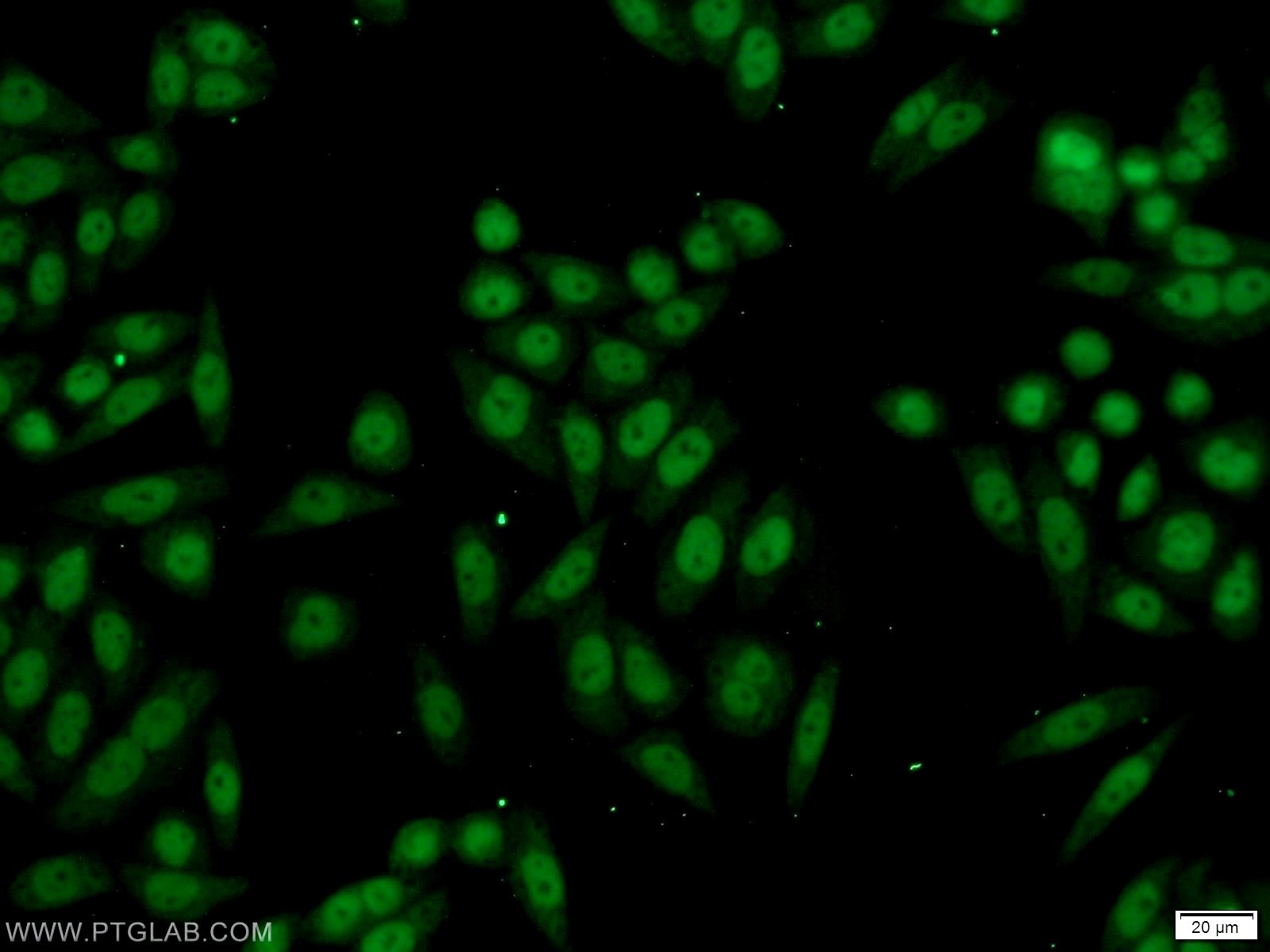Immunofluorescence (IF) / fluorescent staining of HeLa cells using RBAP48 Polyclonal antibody (20364-1-AP)