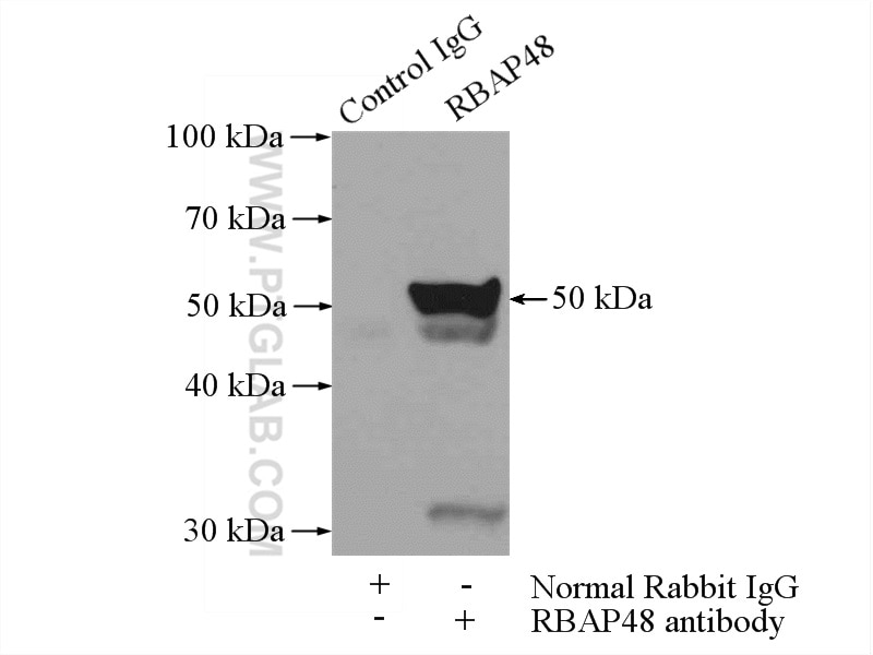 Immunoprecipitation (IP) experiment of HeLa cells using RBAP48 Polyclonal antibody (20364-1-AP)