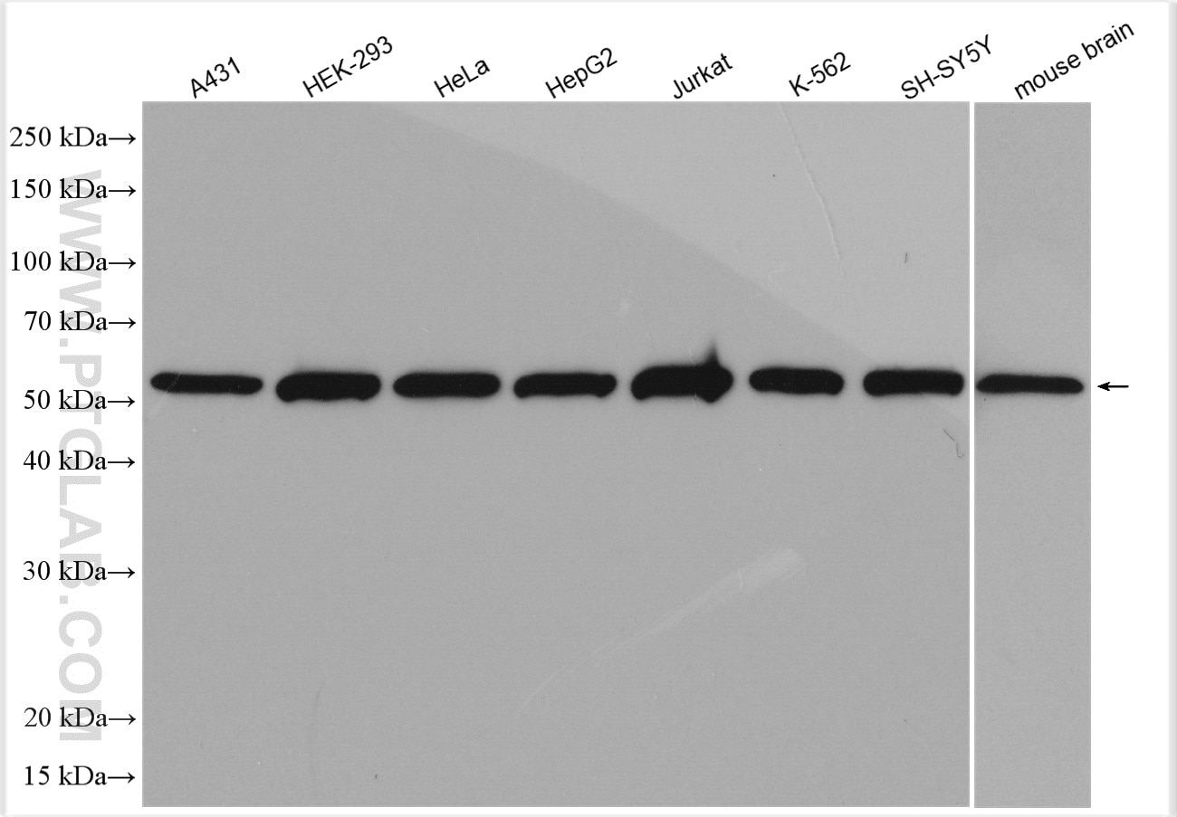 Western Blot (WB) analysis of various lysates using RBAP48 Polyclonal antibody (20364-1-AP)