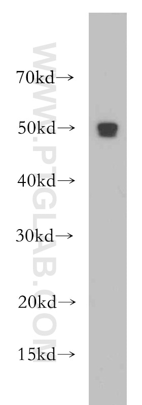 WB analysis of L02 using 20364-1-AP