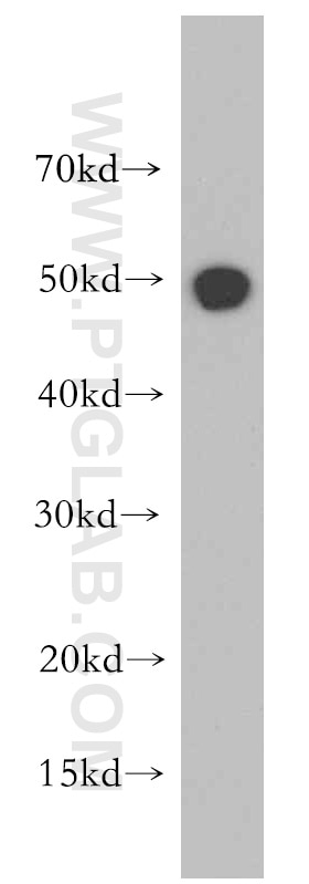 Western Blot (WB) analysis of Jurkat cells using RBAP48 Polyclonal antibody (20364-1-AP)