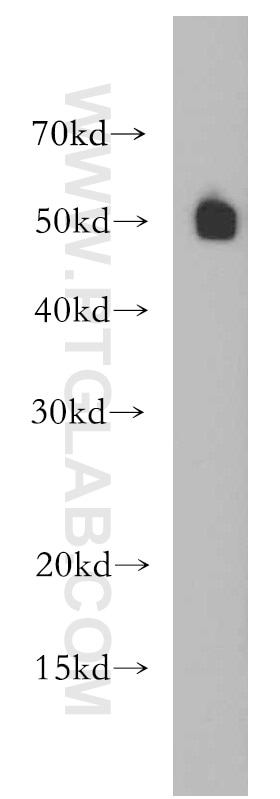 Western Blot (WB) analysis of HeLa cells using RBAP48 Polyclonal antibody (20364-1-AP)