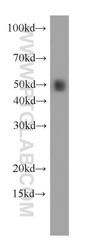 Western Blot (WB) analysis of human brain tissue using RBAP48 Polyclonal antibody (20364-1-AP)