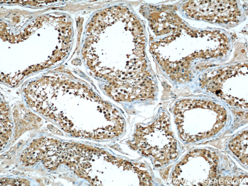 IHC staining of human testis using 66060-1-Ig