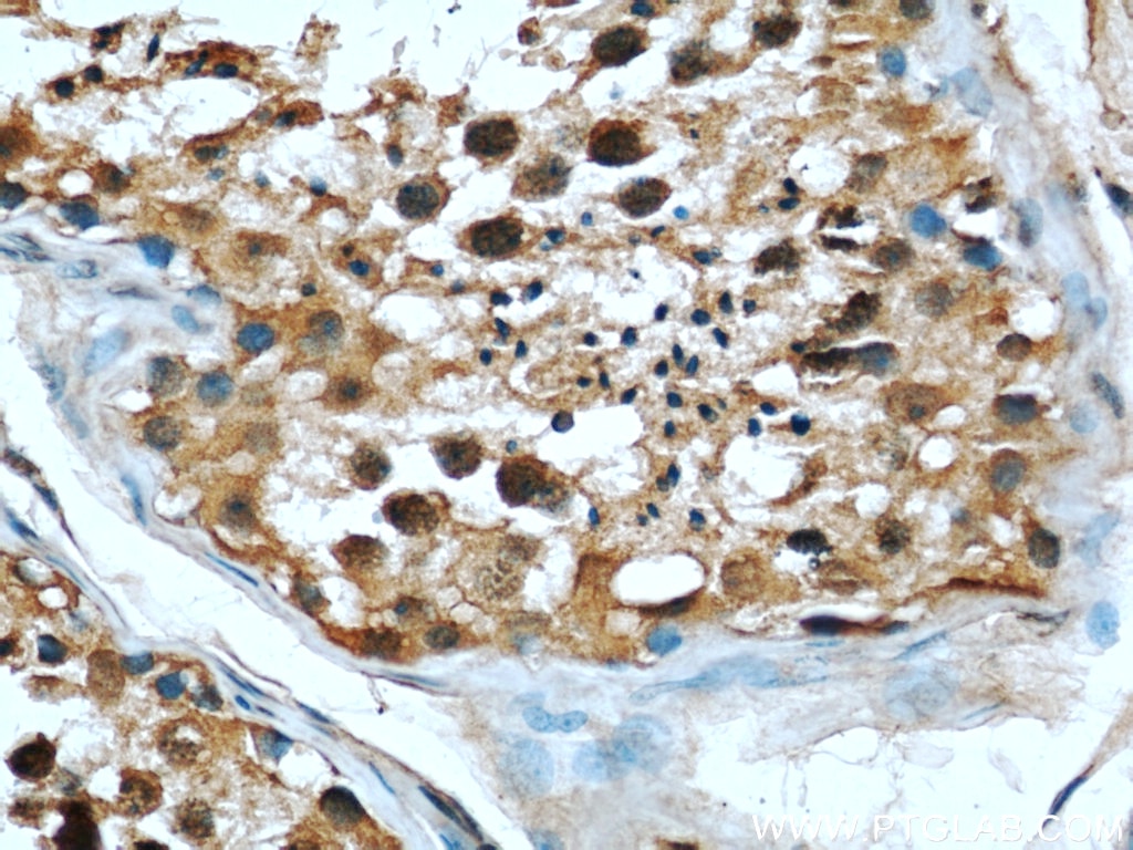 Immunohistochemistry (IHC) staining of human testis tissue using RBAP48 Monoclonal antibody (66060-1-Ig)