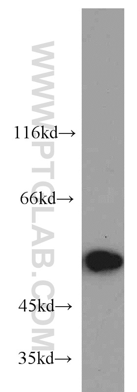 Western Blot (WB) analysis of HeLa cells using RBAP48 Monoclonal antibody (66060-1-Ig)