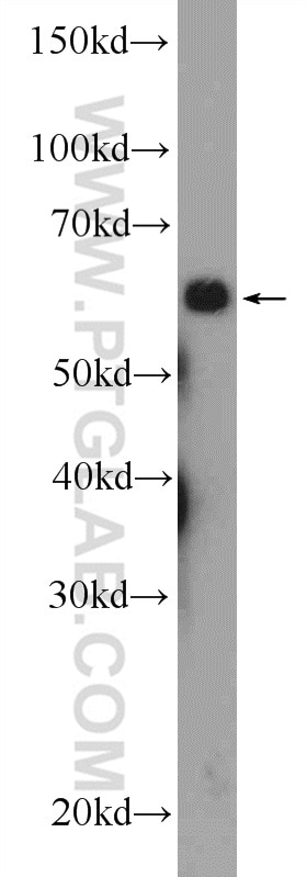 Western Blot (WB) analysis of HL-60 cells using RBBP5 Polyclonal antibody (13181-1-AP)