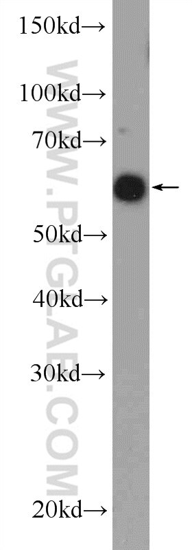 Western Blot (WB) analysis of HL-60 cells using RBBP5 Polyclonal antibody (13181-1-AP)