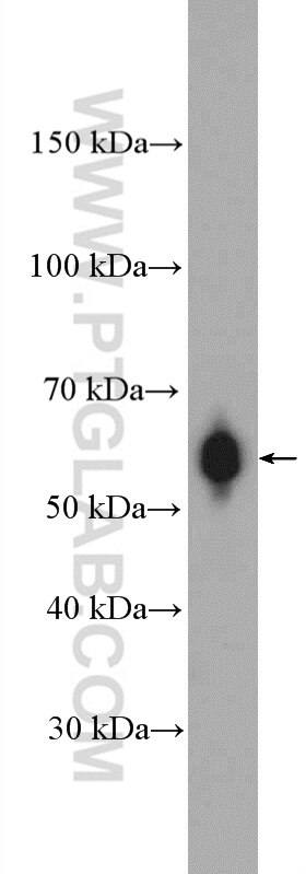 Western Blot (WB) analysis of HeLa cells using RBBP5 Polyclonal antibody (13181-1-AP)