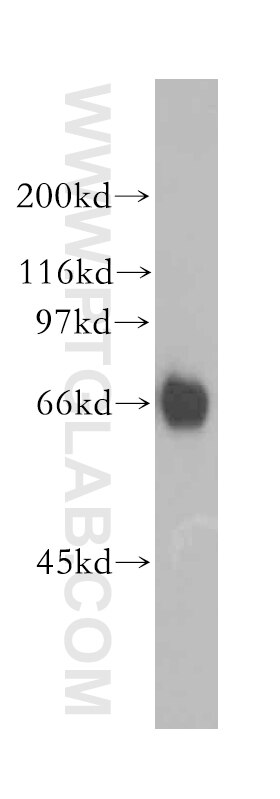 Western Blot (WB) analysis of HL-60 cells using RBBP5 Polyclonal antibody (13181-1-AP)