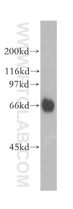 Western Blot (WB) analysis of HL-60 cells using RBBP5 Polyclonal antibody (13181-1-AP)