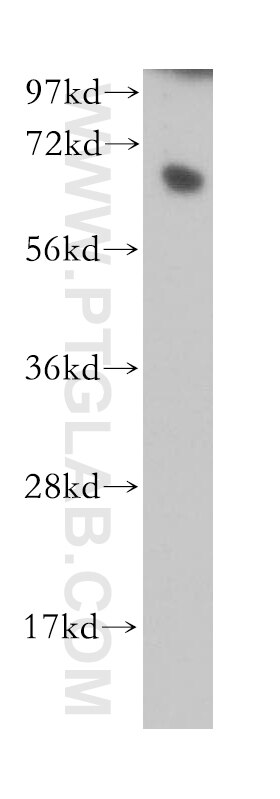 Western Blot (WB) analysis of HL-60 cells using RBBP5 Polyclonal antibody (13181-1-AP)