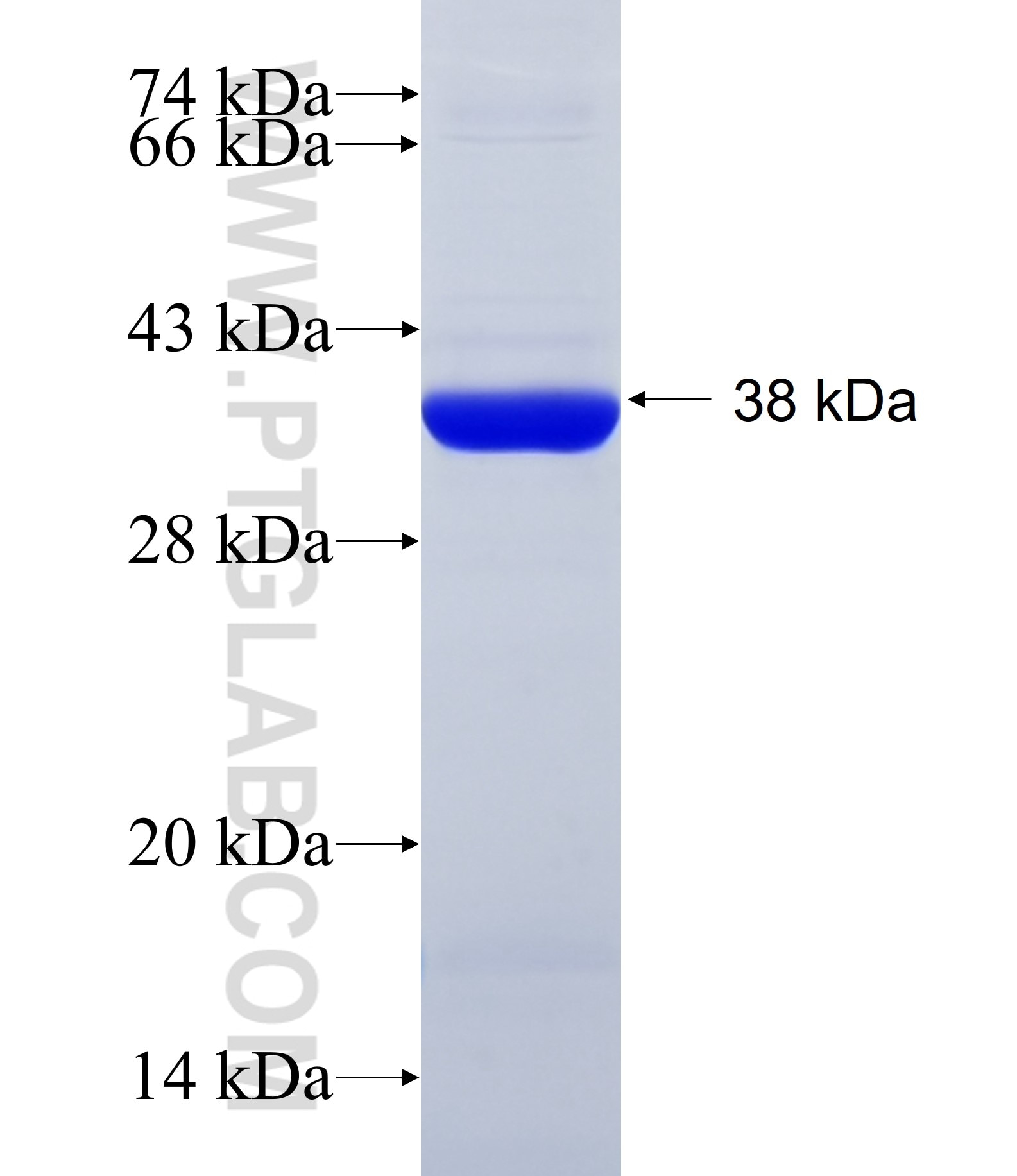 RBBP5 fusion protein Ag34568 SDS-PAGE RBBP5 fusion protein Ag34568 SDS-PAGE