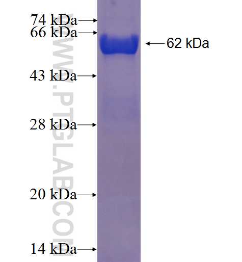 RBBP5 fusion protein Ag3848 SDS-PAGE