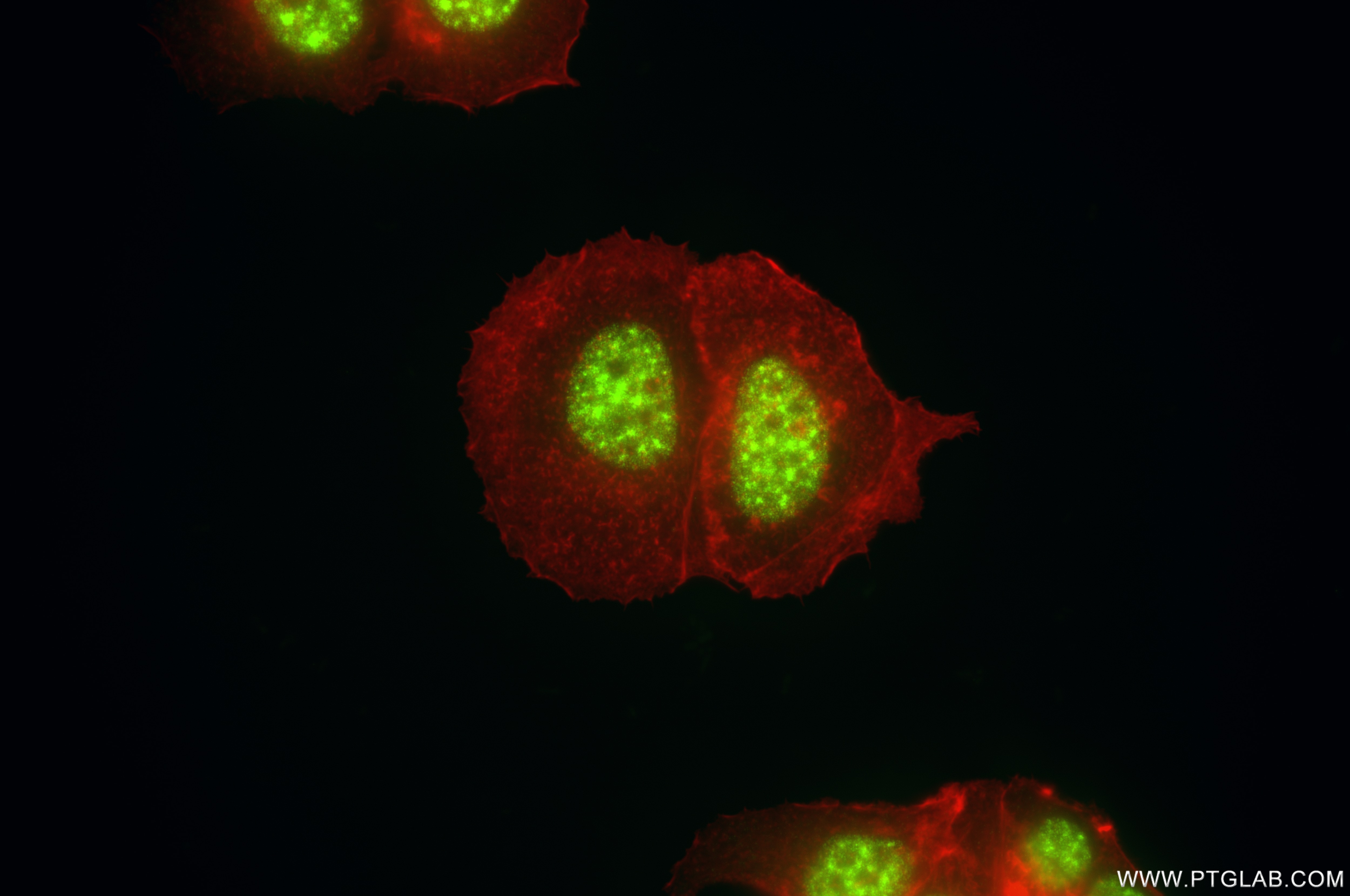 Immunofluorescence (IF) / fluorescent staining of MCF-7 cells using RBBP6 Recombinant antibody (85884-5-RR)