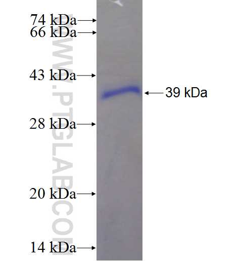 RBBP6 fusion protein Ag2484 SDS-PAGE