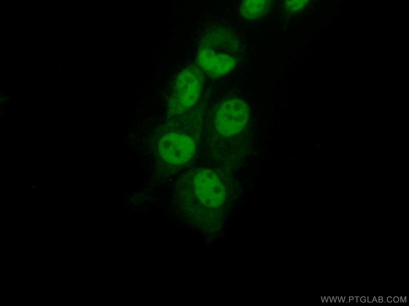 Immunofluorescence (IF) / fluorescent staining of A431 cells using RbAp46 Polyclonal antibody (20365-1-AP)