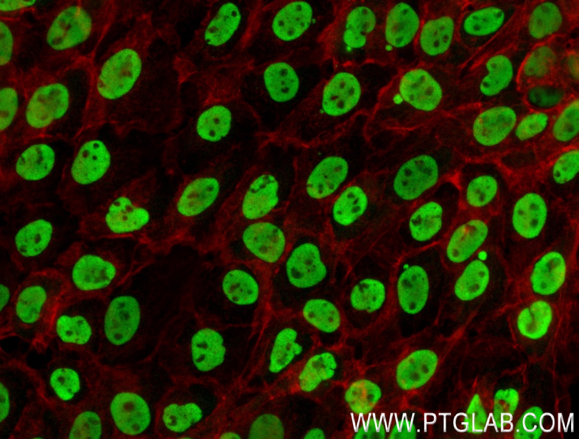 Immunofluorescence (IF) / fluorescent staining of A431 cells using RBBP7 Recombinant antibody (84330-1-RR)