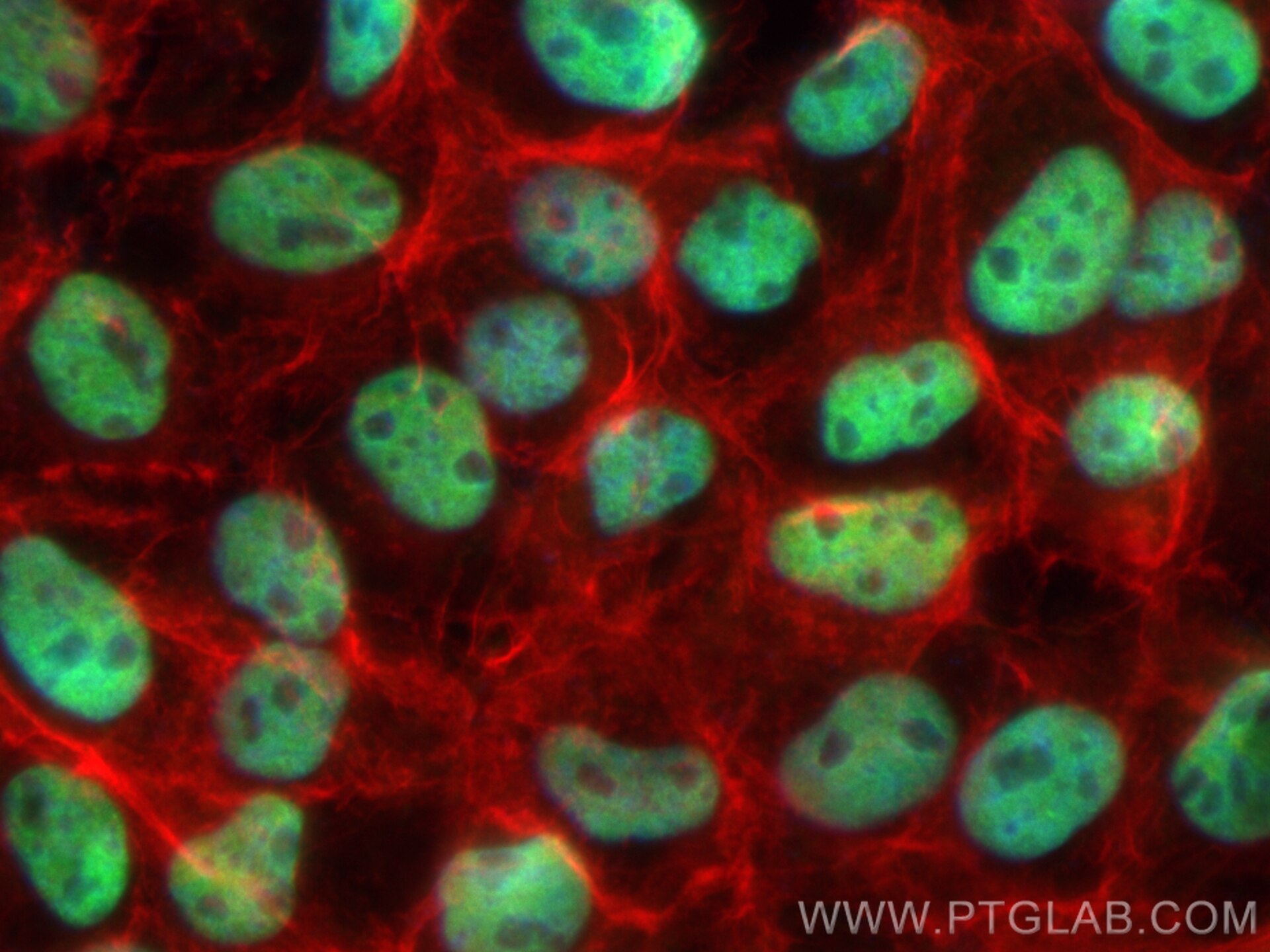Immunofluorescence (IF) / fluorescent staining of A431 cells using CoraLite® Plus 488-conjugated RBBP7 Recombinant an (CL488-84330)