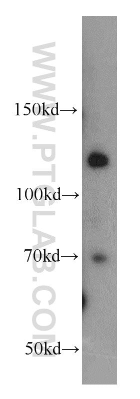 Western Blot (WB) analysis of A431 cells using RBBP8 Polyclonal antibody (12624-1-AP)