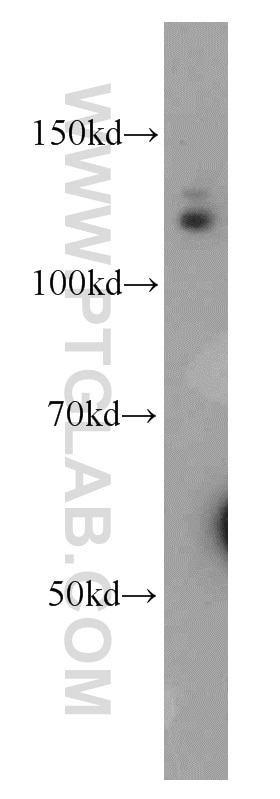 Western Blot (WB) analysis of Raji cells using RBBP8 Polyclonal antibody (12624-1-AP)