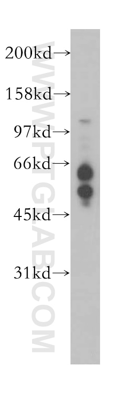 RBBP8 Polyclonal antibody