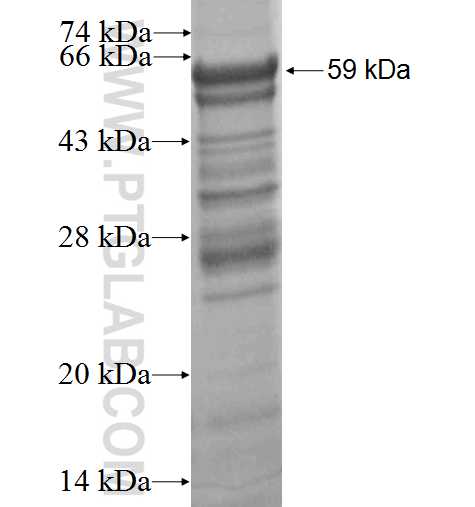RBBP8 fusion protein Ag3314 SDS-PAGE