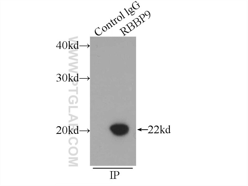 Immunoprecipitation (IP) experiment of mouse lung tissue using RBBP9 Polyclonal antibody (12230-2-AP)
