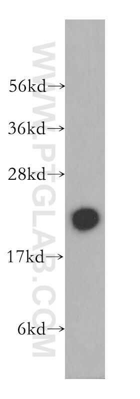 Western Blot (WB) analysis of mouse testis tissue using RBBP9 Polyclonal antibody (12230-2-AP)