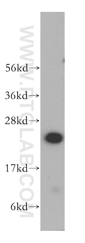 Western Blot (WB) analysis of A375 cells using RBBP9 Polyclonal antibody (12230-2-AP)