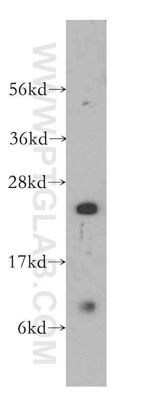 Western Blot (WB) analysis of human spleen tissue using RBBP9 Polyclonal antibody (12230-2-AP)