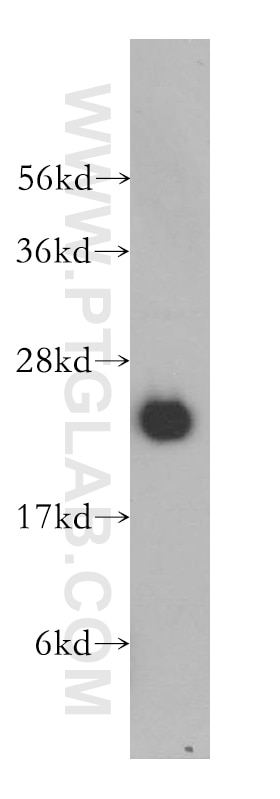 Western Blot (WB) analysis of human lung tissue using RBBP9 Polyclonal antibody (12230-2-AP)