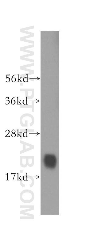 Western Blot (WB) analysis of mouse lung tissue using RBBP9 Polyclonal antibody (12230-2-AP)