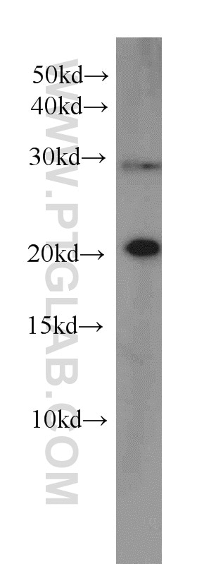 Western Blot (WB) analysis of A549 cells using RBBP9 Monoclonal antibody (66015-1-Ig)