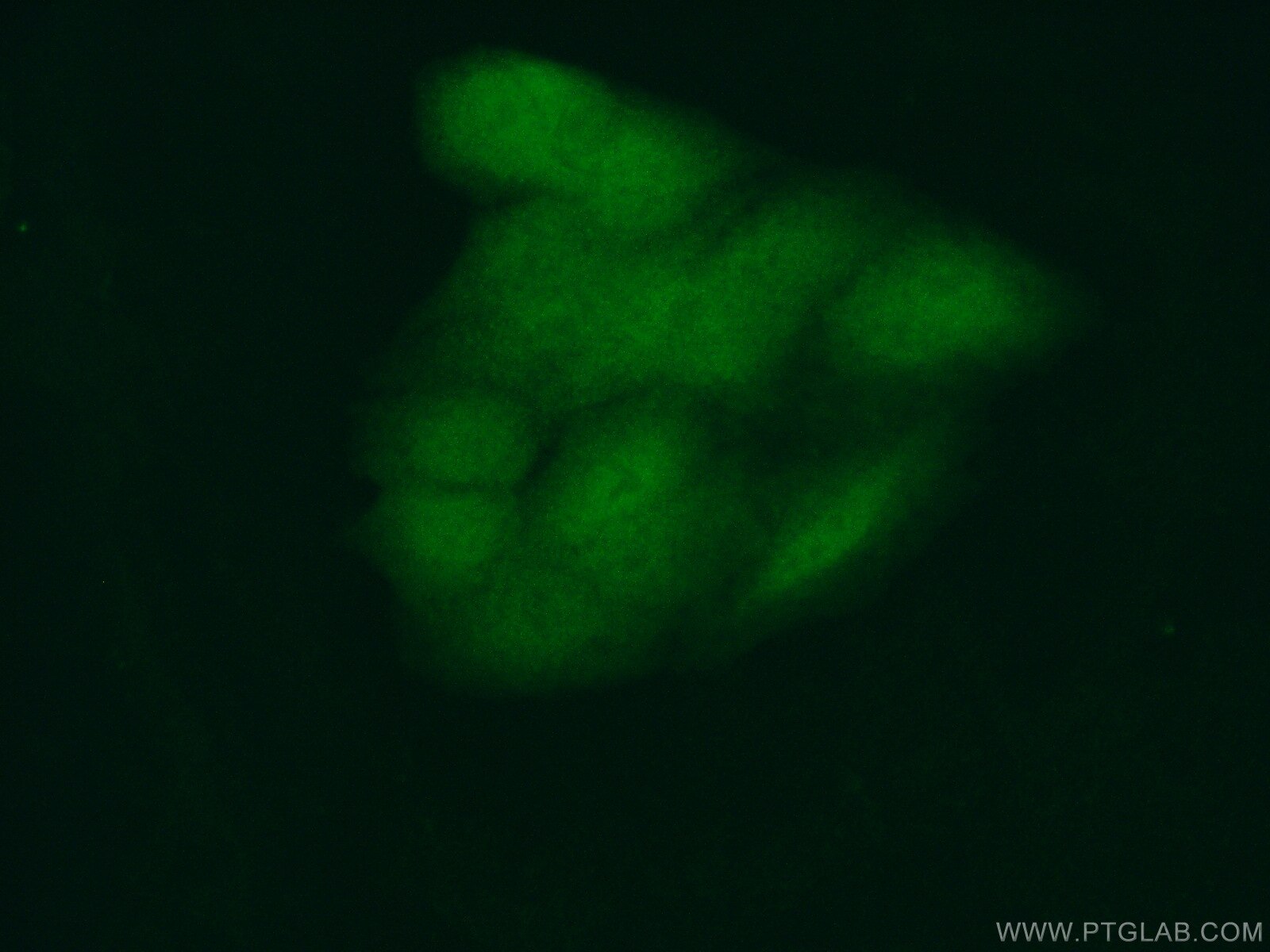 Immunofluorescence (IF) / fluorescent staining of A549 cells using RBBP9 Monoclonal antibody (66015-2-Ig)
