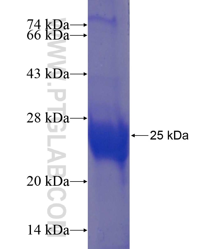 RBBP9 fusion protein Ag17864 SDS-PAGE