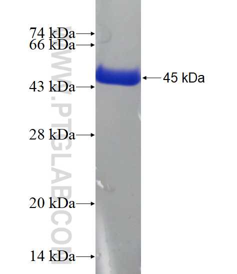 RBBP9 fusion protein Ag2868 SDS-PAGE