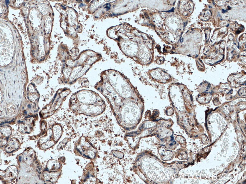 IHC staining of human placenta using 26367-1-AP
