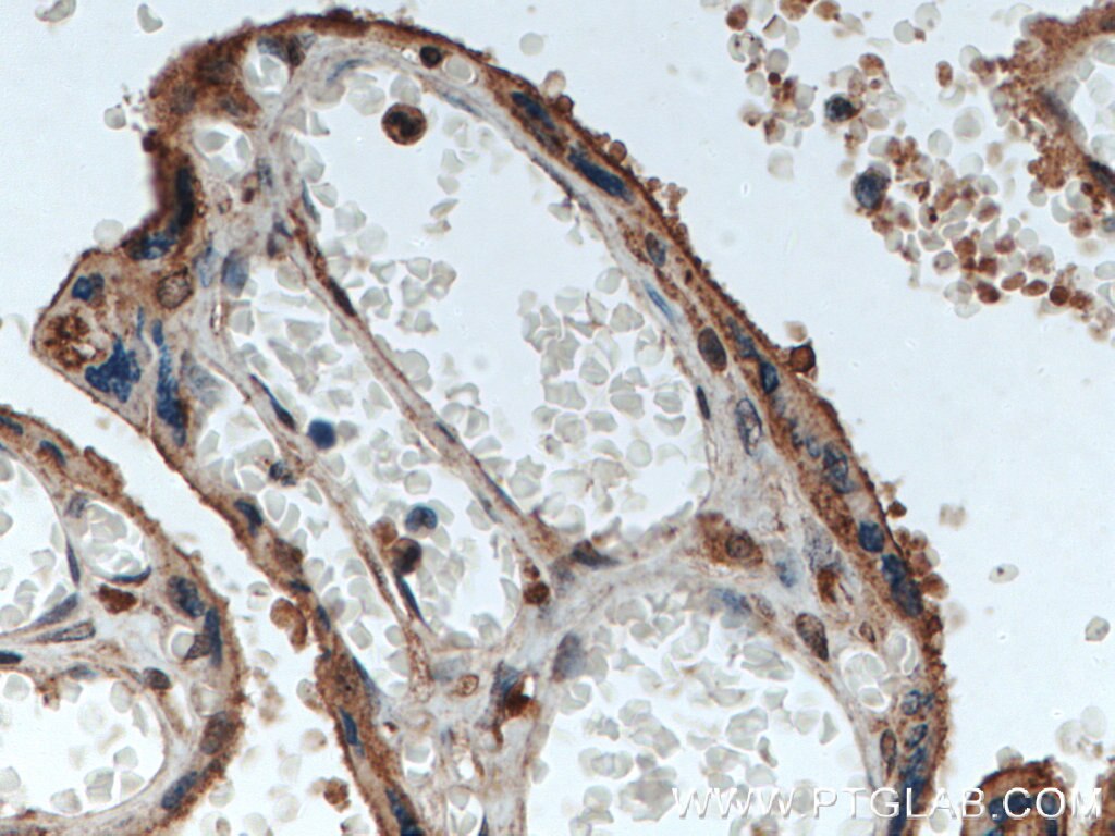 Immunohistochemistry (IHC) staining of human placenta tissue using RBCK1 Polyclonal antibody (26367-1-AP)