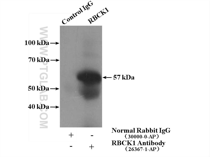 Immunoprecipitation (IP) experiment of human placenta tissue using RBCK1 Polyclonal antibody (26367-1-AP)