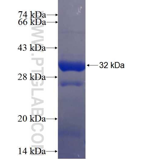 RBCK1 fusion protein Ag24405 SDS-PAGE