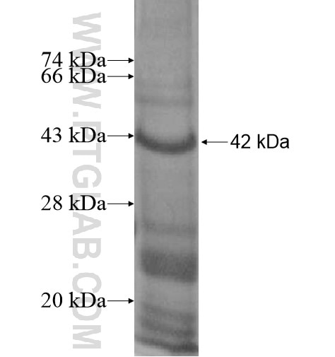 RBCK1 fusion protein Ag13598 SDS-PAGE