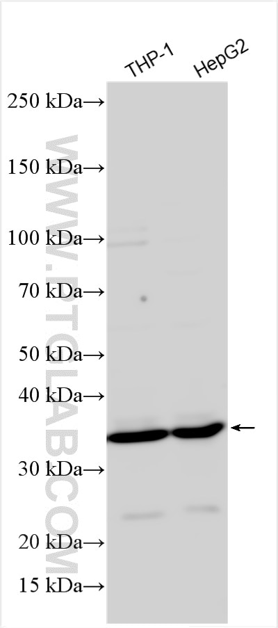 Western Blot (WB) analysis of various lysates using RBKS Polyclonal antibody (31590-1-AP)