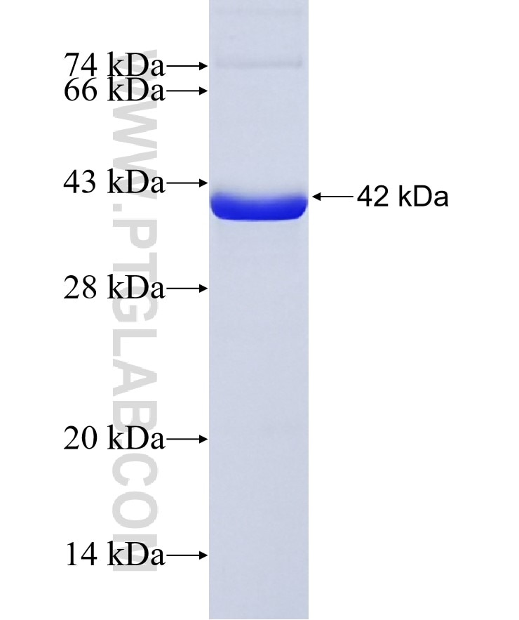 RBKS fusion protein Ag36433 SDS-PAGE