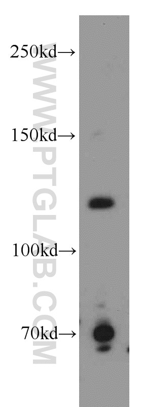 Western Blot (WB) analysis of COLO 320 cells using p107 Polyclonal antibody (13354-1-AP)