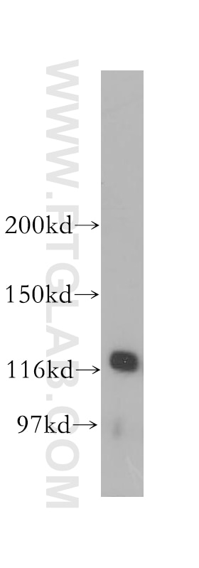 WB analysis of mouse testis using 13354-1-AP